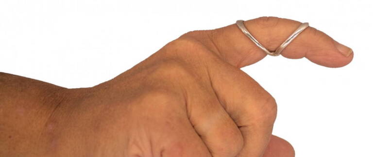 Silversplint, KC Pedersen